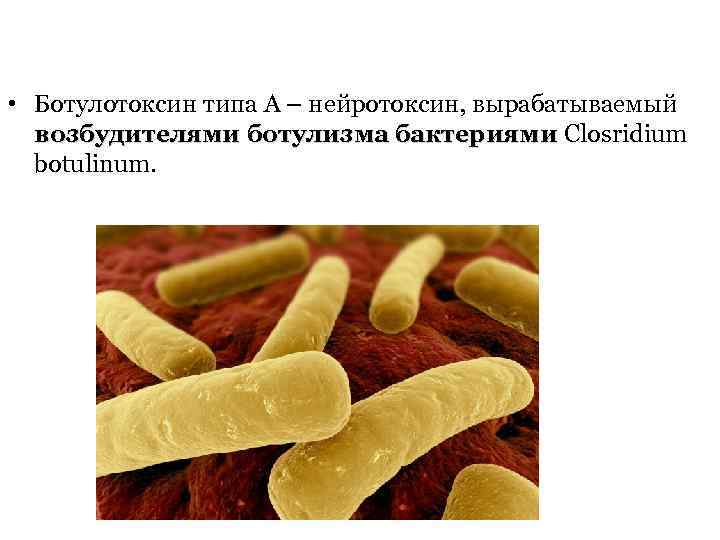  • Ботулотоксин типа А – нейротоксин, вырабатываемый возбудителями ботулизма бактериями Closridium botulinum. 