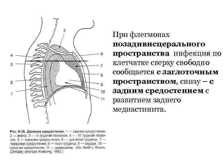 При флегмонах позадивисцерального пространства инфекция по клетчатке сверху свободно сообщается с заглоточным пространством, снизу