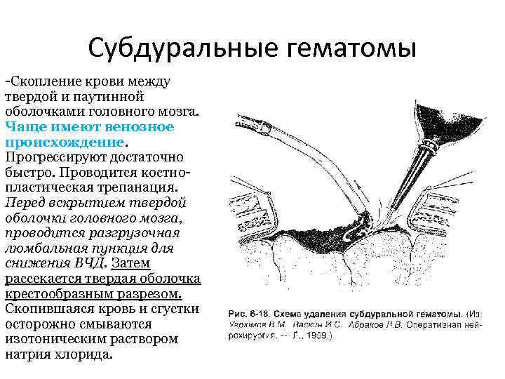 Субдуральные гематомы Скопление крови между твердой и паутинной оболочками головного мозга. Чаще имеют венозное