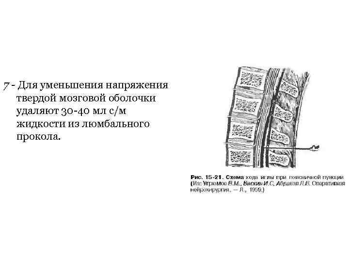 7 - Для уменьшения напряжения твердой мозговой оболочки удаляют 30 40 мл с/м жидкости