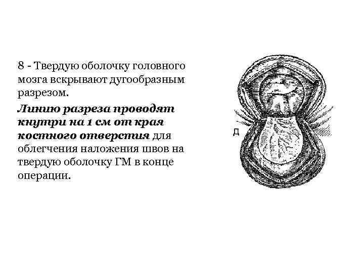 8 Твердую оболочку головного мозга вскрывают дугообразным разрезом. Линию разреза проводят кнутри на 1