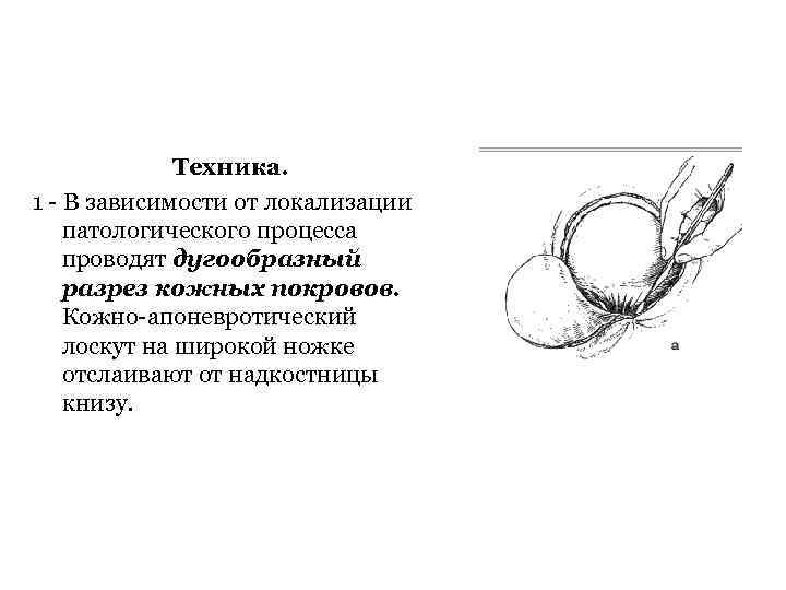 Техника. 1 В зависимости от локализации патологического процесса проводят дугообразный разрез кожных покровов. Кожно