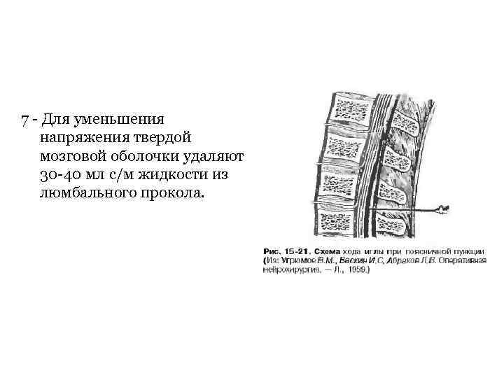 7 Для уменьшения напряжения твердой мозговой оболочки удаляют 30 40 мл с/м жидкости из