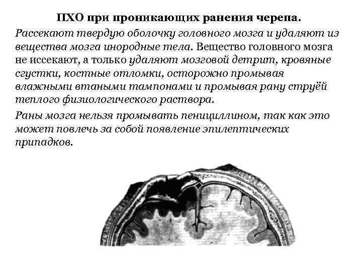 ПХО при проникающих ранения черепа. Рассекают твердую оболочку головного мозга и удаляют из вещества