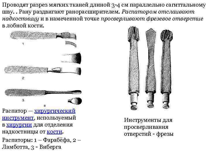 Проведенный разрез