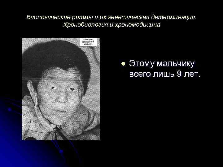 Биологические ритмы и их генетическая детерминация. Хронобиология и хрономедицина l Этому мальчику всего лишь