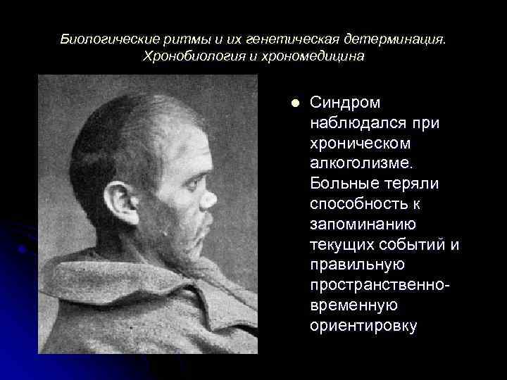 Биологические ритмы и их генетическая детерминация. Хронобиология и хрономедицина l Синдром наблюдался при хроническом