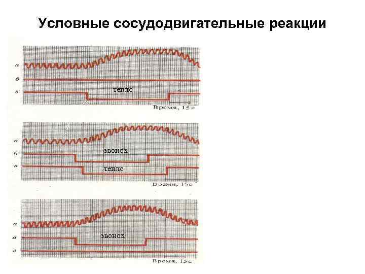 Условные сосудодвигательные реакции тепло звонок 