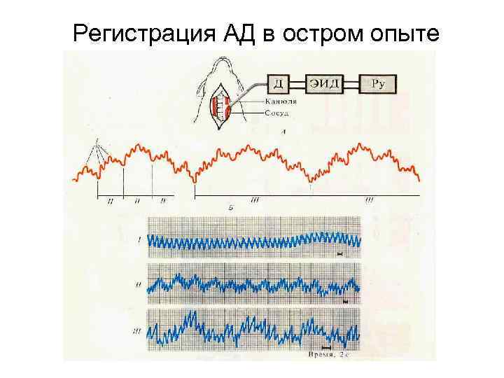 Регистрация АД в остром опыте 