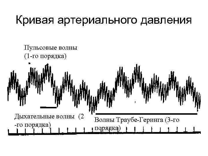 Кривая артериального давления Пульсовые волны (1 -го порядка) Дыхательные волны (2 -го порядка) Волны