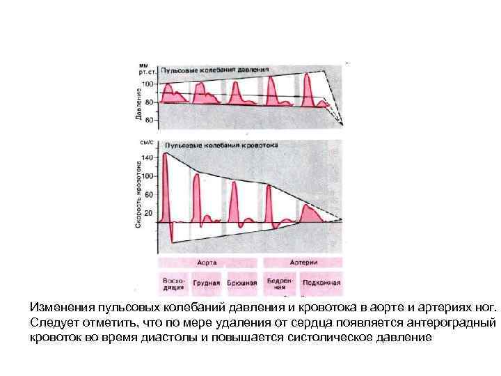 Изменения пульсовых колебаний давления и кровотока в аорте и артериях ног. Следует отметить, что