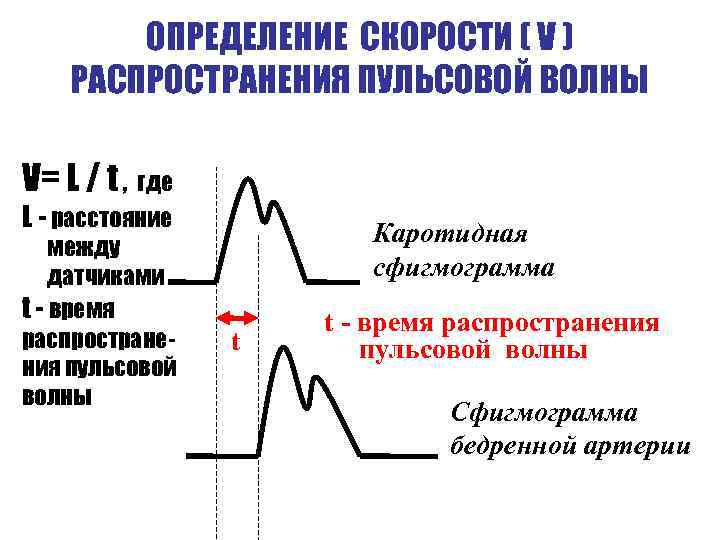 ОПРЕДЕЛЕНИЕ СКОРОСТИ ( V ) РАСПРОСТРАНЕНИЯ ПУЛЬСОВОЙ ВОЛНЫ V= L / t , где