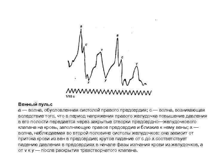 Отрицательный венный пульс