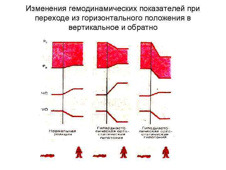 Изменения гемодинамических показателей при переходе из горизонтального положения в вертикальное и обратно 