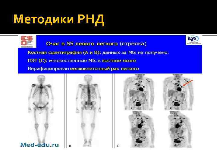 Методики РНД 