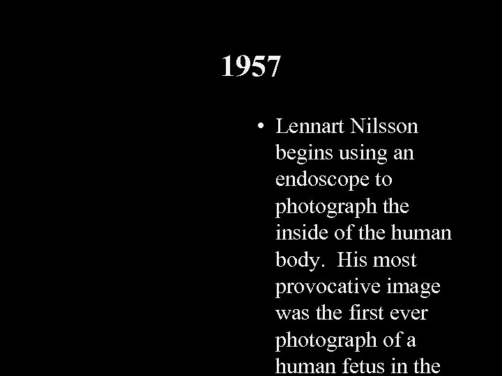 1957 • Lennart Nilsson begins using an endoscope to photograph the inside of the