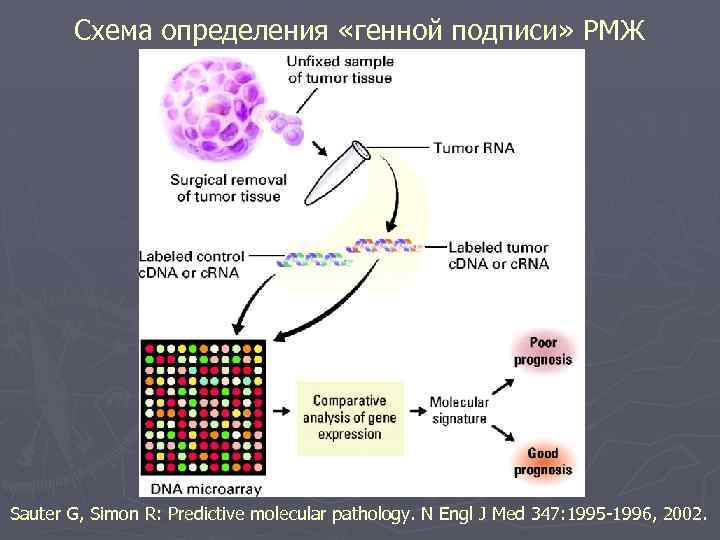 Схема определения «генной подписи» РМЖ Sauter G, Simon R: Predictive molecular pathology. N Engl