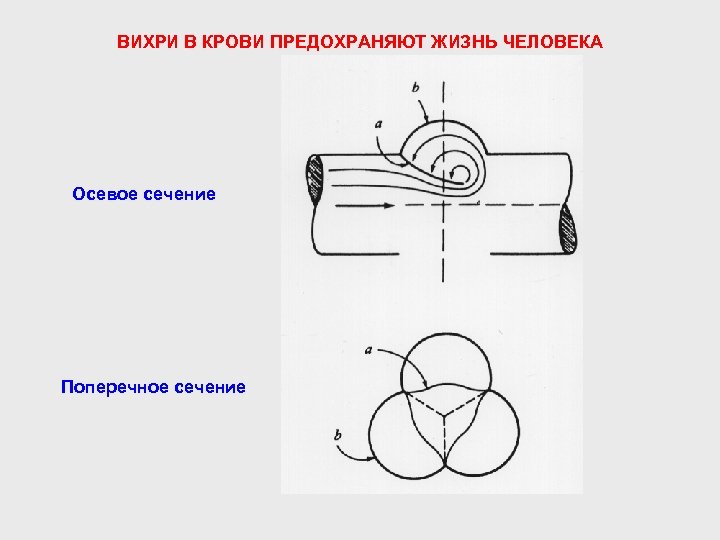 ВИХРИ В КРОВИ ПРЕДОХРАНЯЮТ ЖИЗНЬ ЧЕЛОВЕКА Осевое сечение Поперечное сечение 