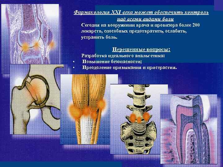 Фармакология XXI века может обеспечить контроль над всеми видами боли Сегодня на вооружении врача
