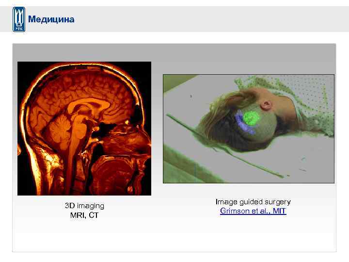 Медицина 3 D imaging MRI, CT Image guided surgery Grimson et al. , MIT