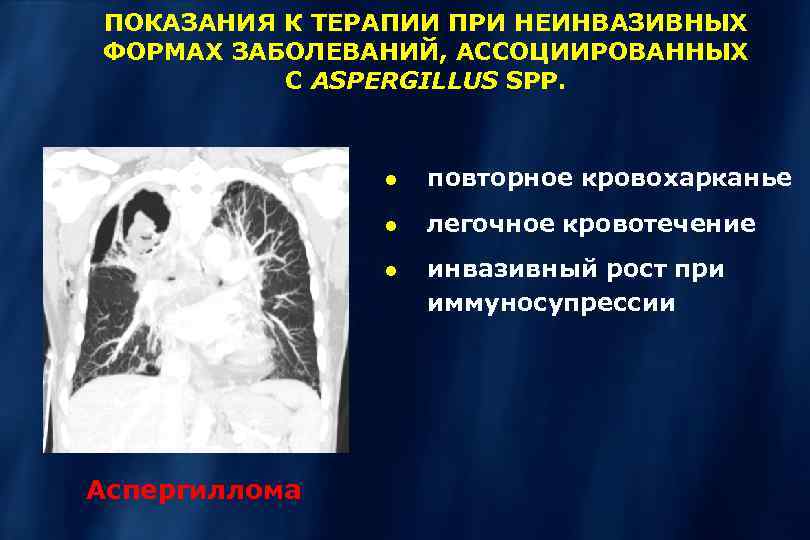 ПОКАЗАНИЯ К ТЕРАПИИ ПРИ НЕИНВАЗИВНЫХ ФОРМАХ ЗАБОЛЕВАНИЙ, АССОЦИИРОВАННЫХ С ASPERGILLUS SPP. повторное кровохарканье легочное