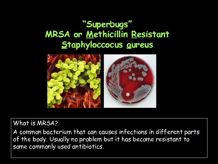 “Superbugs” MRSA or Methicillin Resistant Staphyloccocus aureus What is MRSA? A common bacterium that