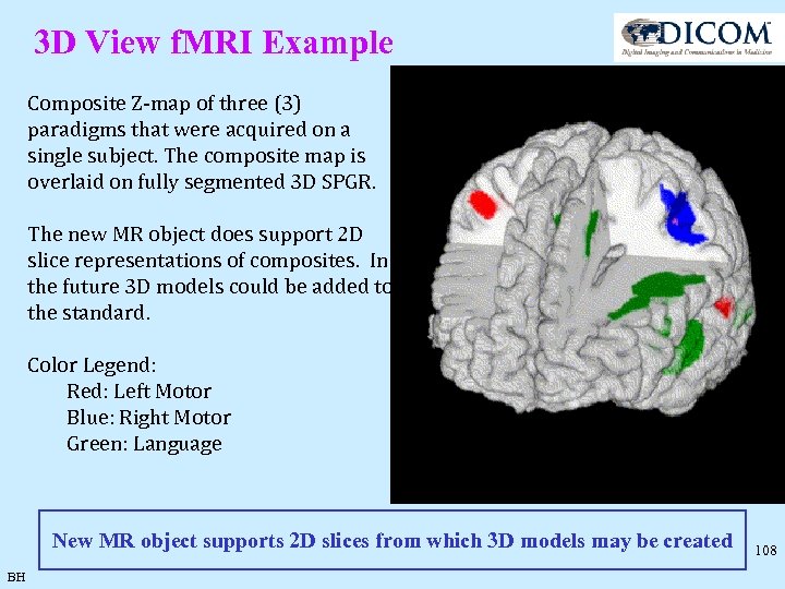 3 D View f. MRI Example Composite Z-map of three (3) paradigms that were