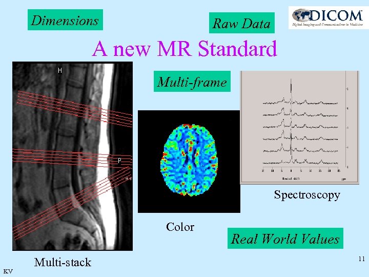 Dimensions Raw Data A new MR Standard Multi-frame Spectroscopy Color KV Multi-stack Real World