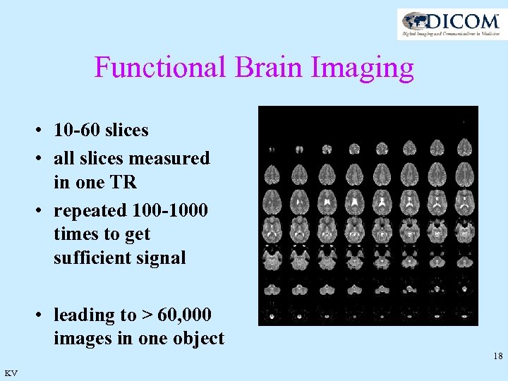 Functional Brain Imaging • 10 -60 slices • all slices measured in one TR