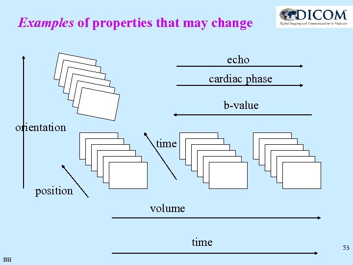 Examples of properties that may change echo cardiac phase b-value orientation time position volume