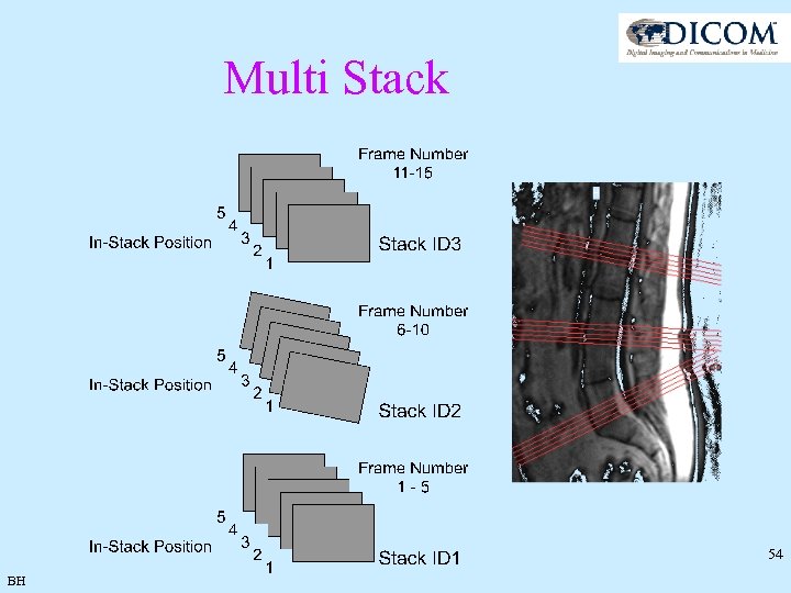 Multi Stack 54 BH 