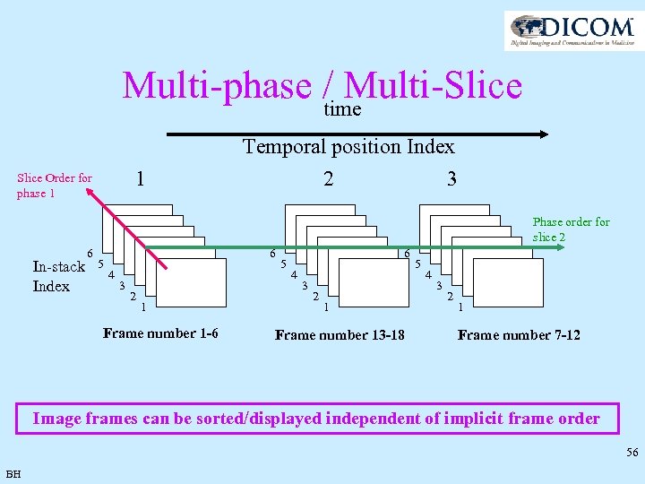 Multi-phase / Multi-Slice time 1 Slice Order for phase 1 Temporal position Index 2