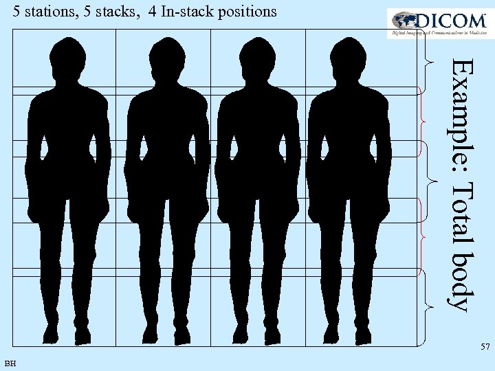 5 stations, 5 stacks, 4 In-stack positions Example: Total body 57 BH 