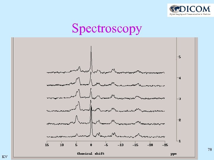 Spectroscopy 78 KV 