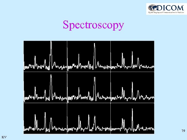 Spectroscopy 79 KV 