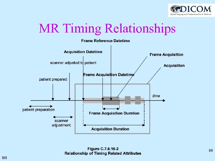 MR Timing Relationships 88 BH 