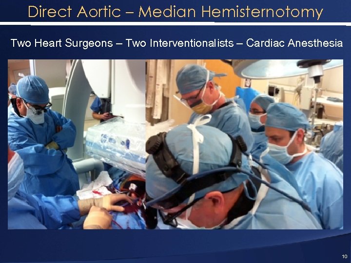 Direct Aortic – Median Hemisternotomy Two Heart Surgeons – Two Interventionalists – Cardiac Anesthesia