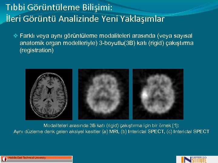 Tıbbi Görüntüleme Bilişimi: İleri Görüntü Analizinde Yeni Yaklaşımlar v Farklı veya aynı görüntüleme modaliteleri