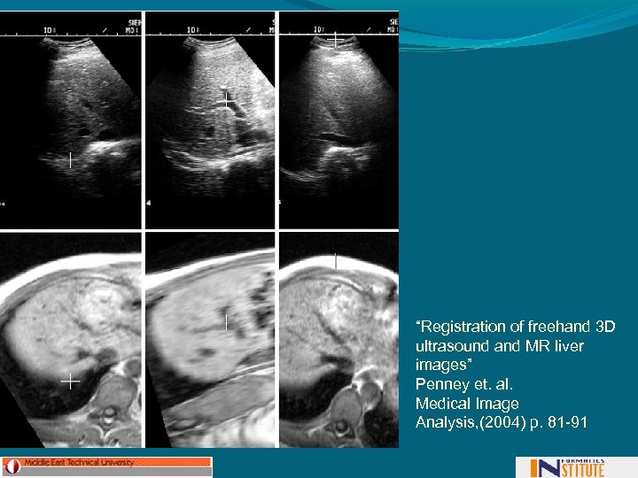 “Registration of freehand 3 D ultrasound and MR liver images” Penney et. al. Medical