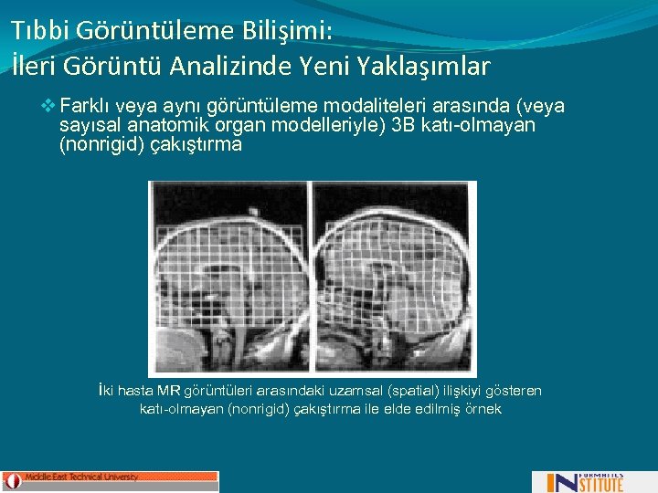 Tıbbi Görüntüleme Bilişimi: İleri Görüntü Analizinde Yeni Yaklaşımlar v Farklı veya aynı görüntüleme modaliteleri