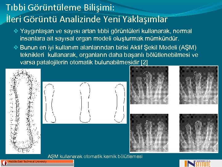 Tıbbi Görüntüleme Bilişimi: İleri Görüntü Analizinde Yeni Yaklaşımlar v Yaygınlaşan ve sayısı artan tıbbi