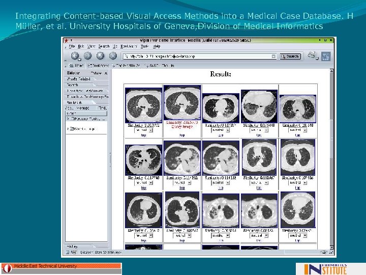 Integrating Content-based Visual Access Methods into a Medical Case Database. H Müller, et al.