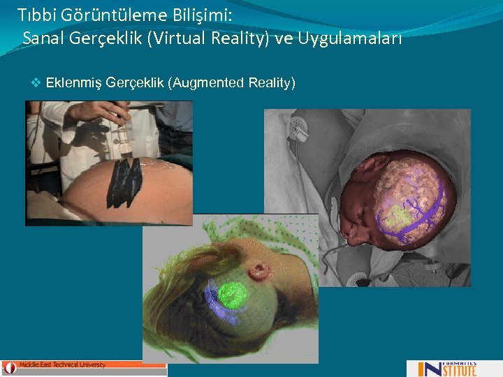 Tıbbi Görüntüleme Bilişimi: Sanal Gerçeklik (Virtual Reality) ve Uygulamaları v Eklenmiş Gerçeklik (Augmented Reality)
