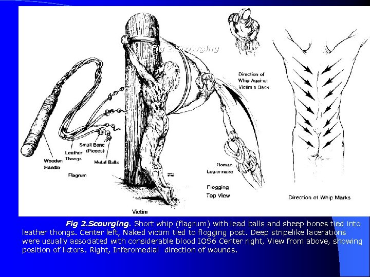 Fig 2. Scourging. Short whip (flagrum) with lead balls and sheep bones tied into
