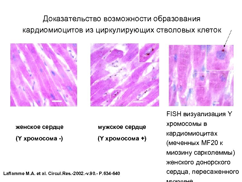 Доказательство возможности образования кардиомиоцитов из циркулирующих стволовых клеток женское сердце мужское сердце (Y хромосома