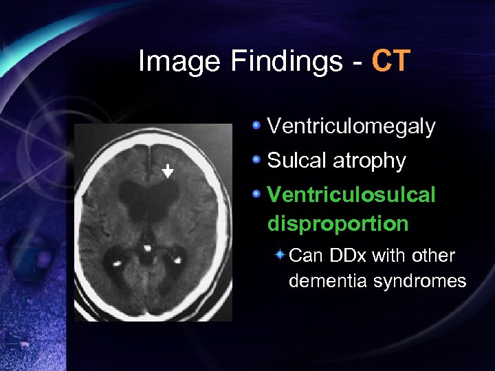 Image Findings - CT Ventriculomegaly Sulcal atrophy Ventriculosulcal disproportion Can DDx with other dementia