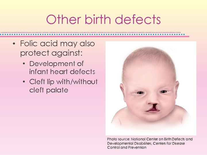 Other birth defects • Folic acid may also protect against: • Development of infant