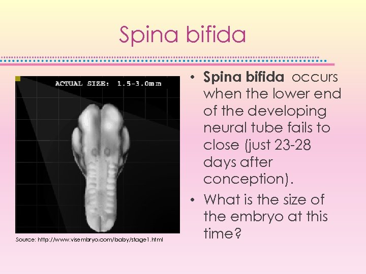 Spina bifida Source: http: //www. visembryo. com/baby/stage 1. html • Spina bifida occurs when