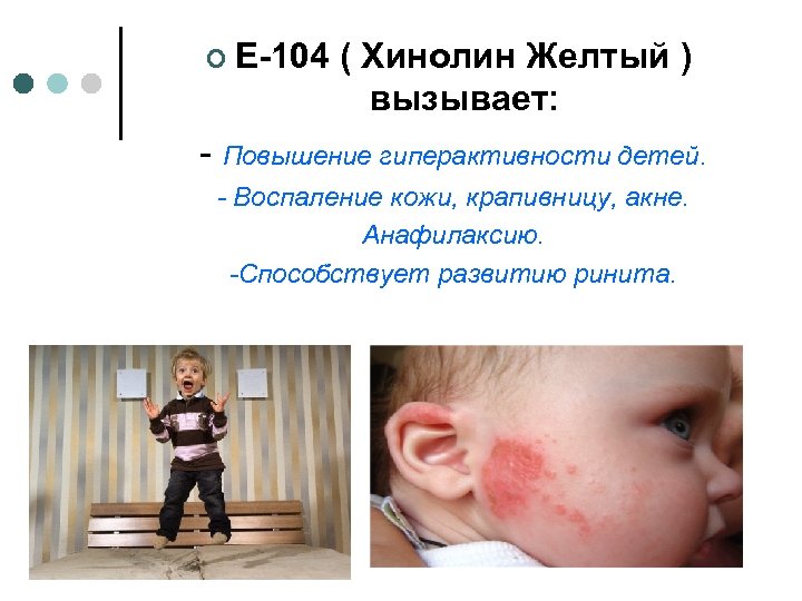¢ Е-104 ( Хинолин Желтый ) вызывает: - Повышение гиперактивности детей. - Воспаление кожи,