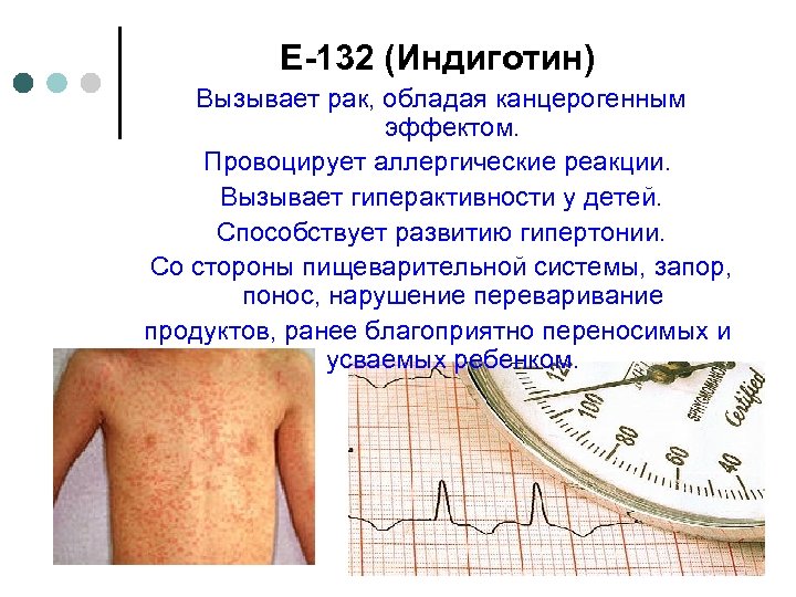 Е-132 (Индиготин) Вызывает рак, обладая канцерогенным эффектом. Провоцирует аллергические реакции. Вызывает гиперактивности у детей.